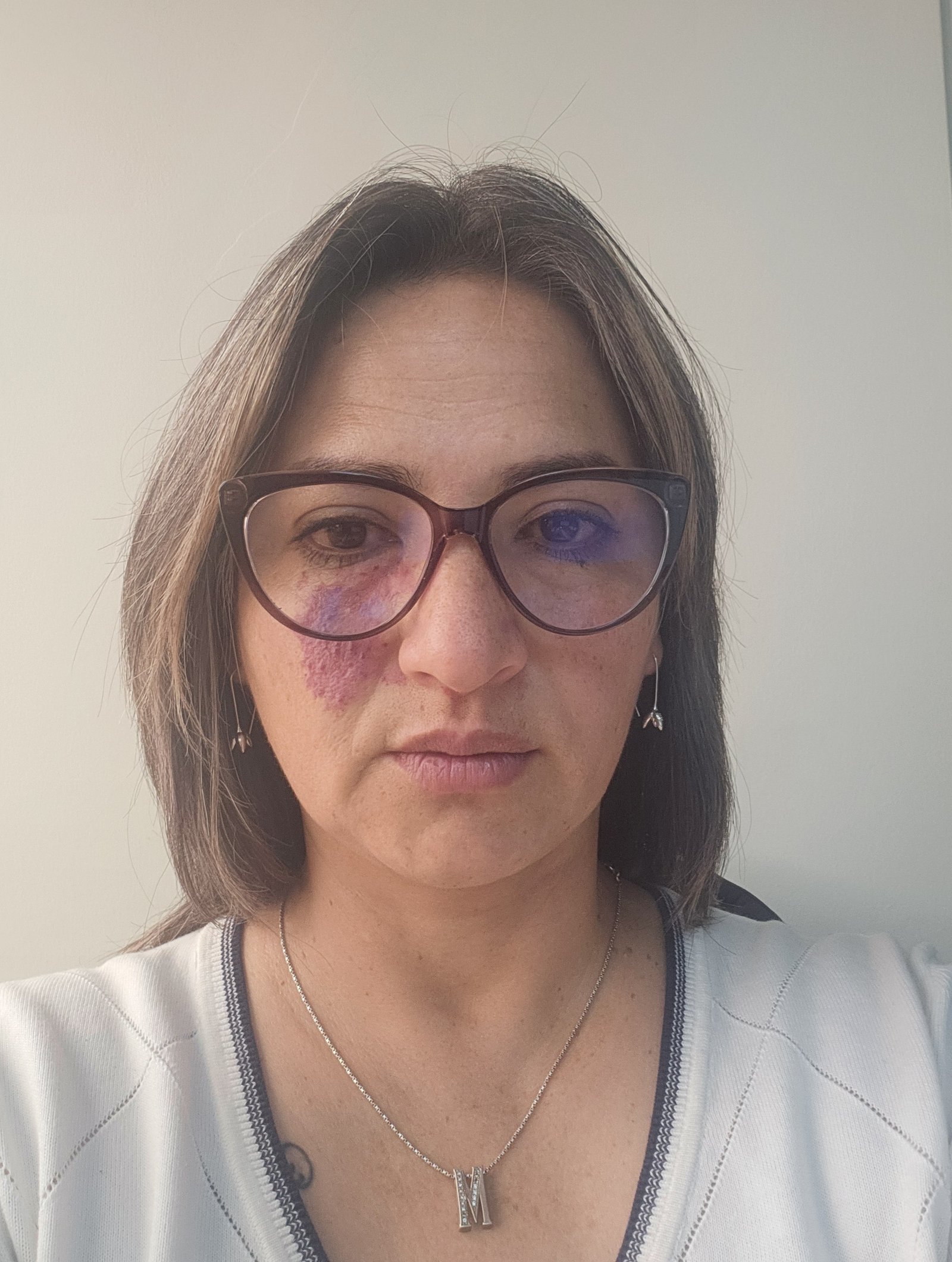 SIN FOTO
