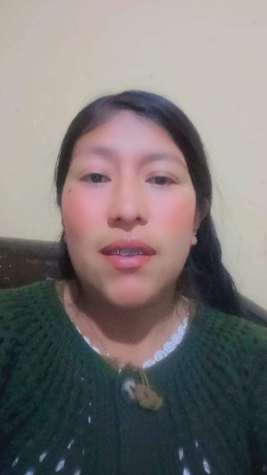 SIN FOTO