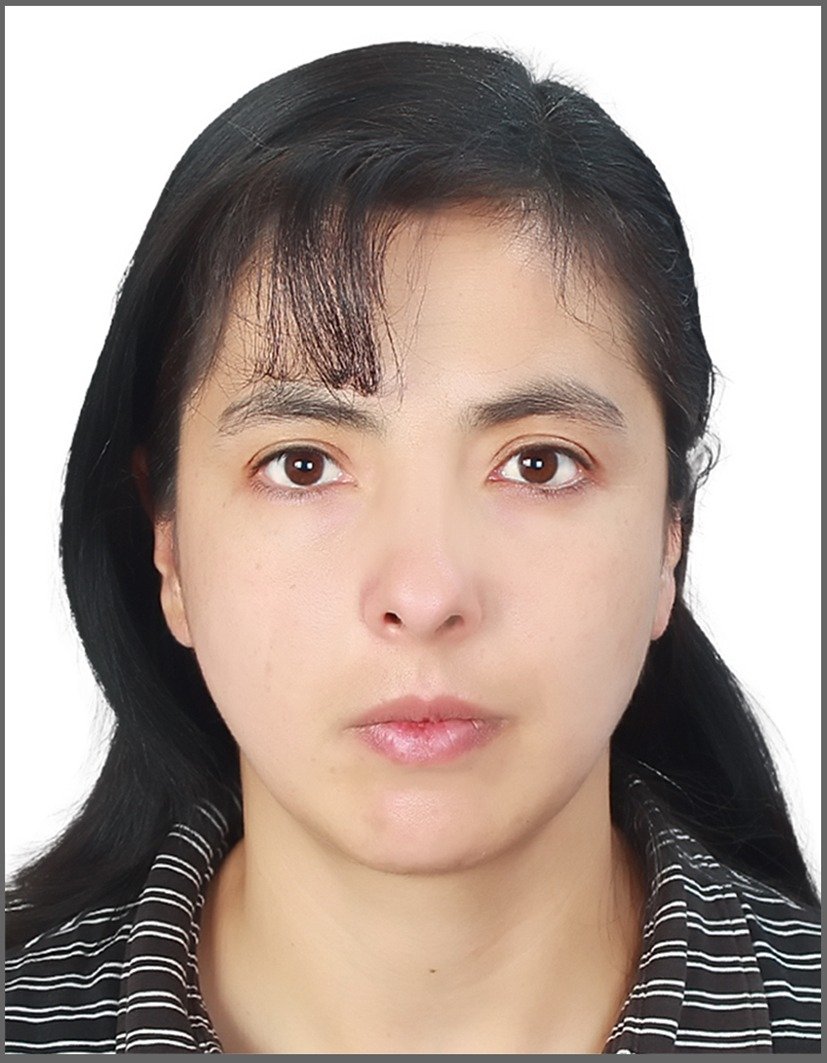SIN FOTO